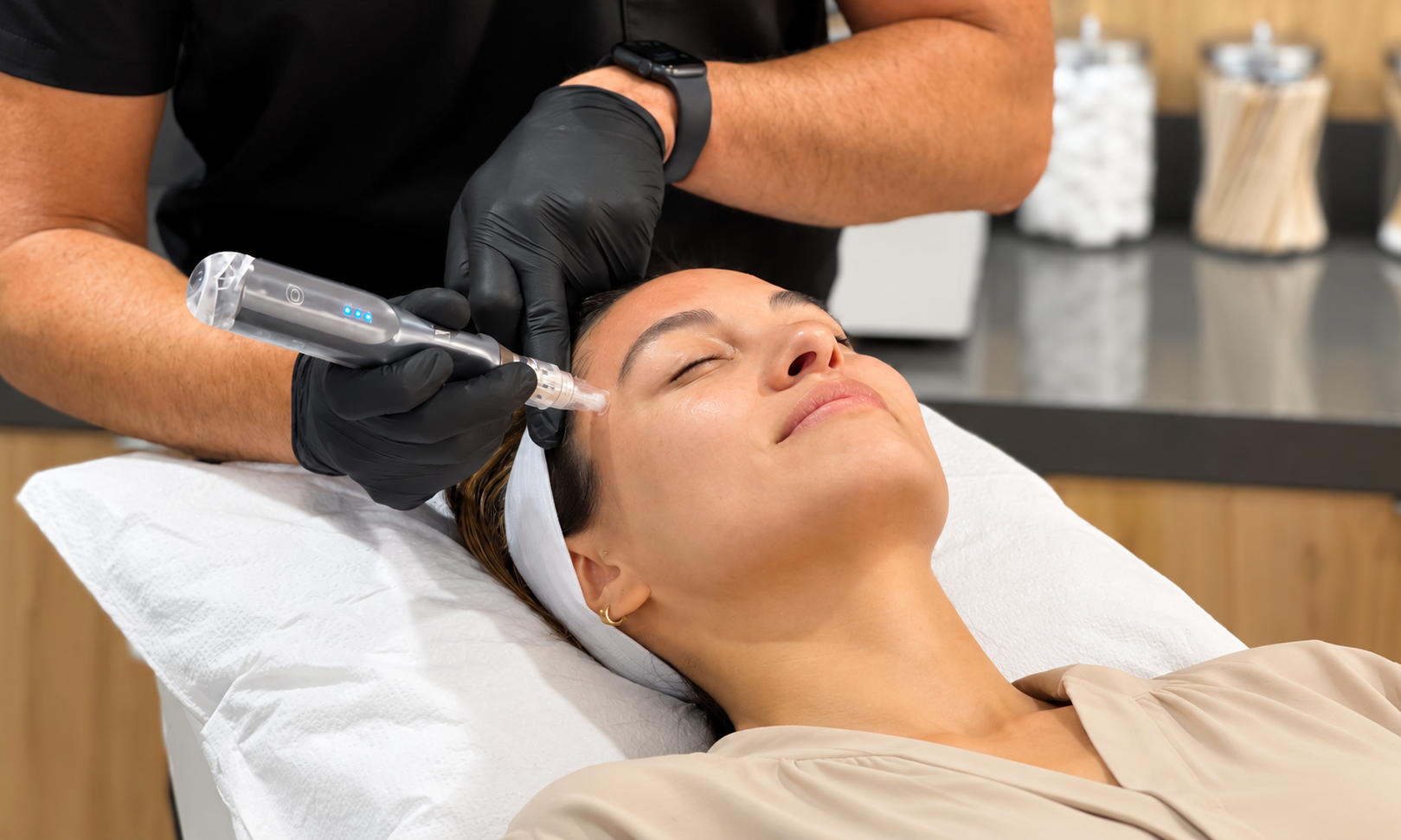 Microneedling with HA