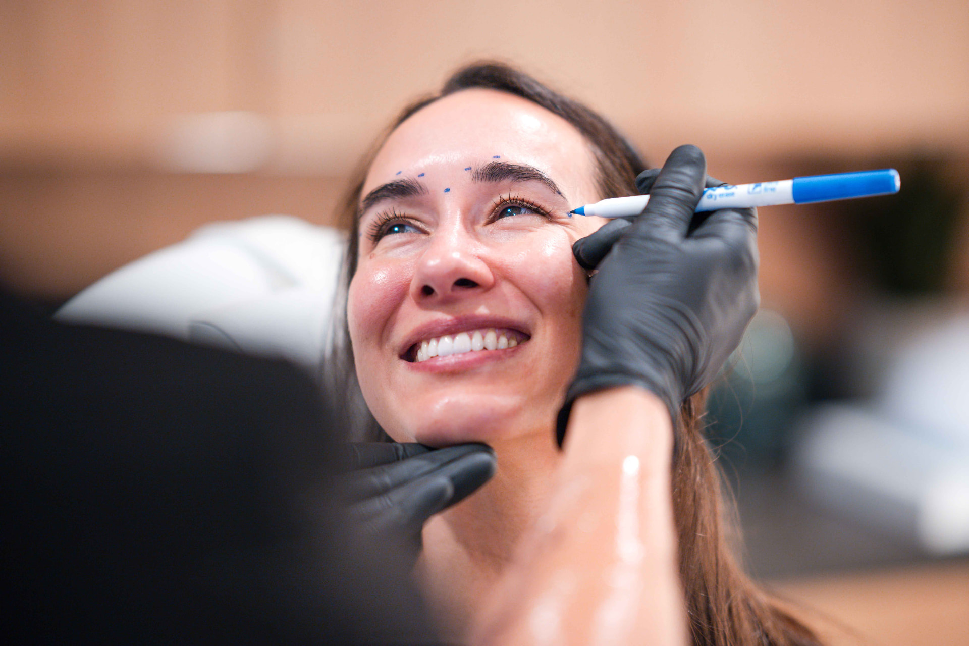 Dermal Fillers