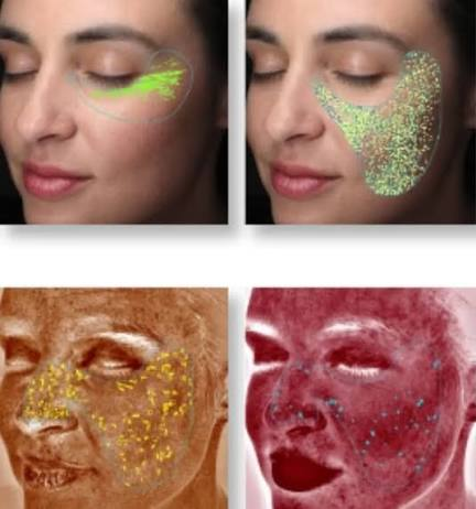 VISIA 3D skin analysis results showing spots, wrinkles, pores and UV damage